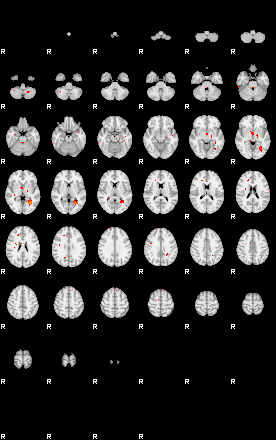 Patients 29162 32