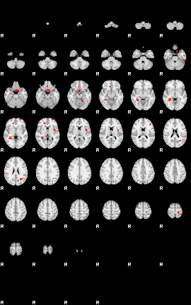 Patients 29162 96