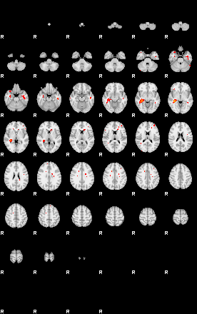 Patients 29163 37