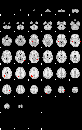 Patients 29165 169