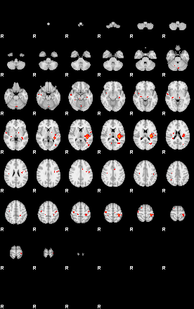 Patients 29168 90