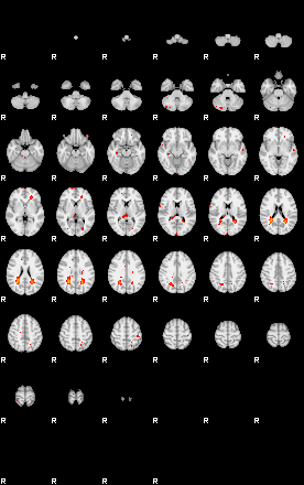 Patients 29170 183