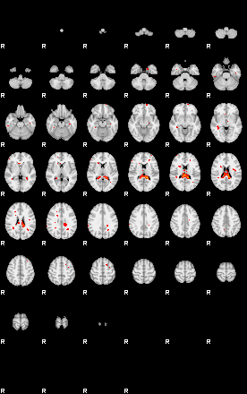 Patients 29172 163