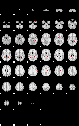 Patients 29172 51