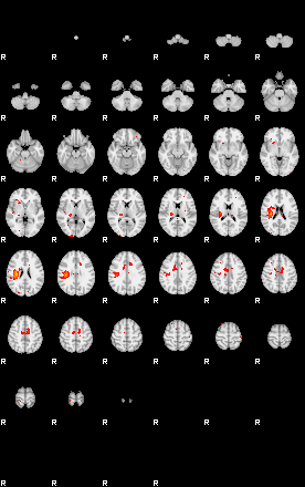 Patients 29173 166