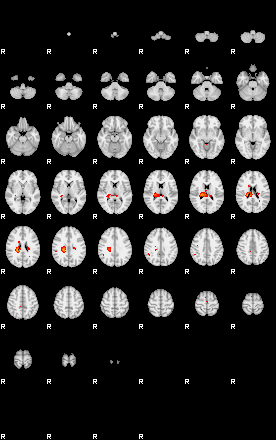 Patients 29173 58