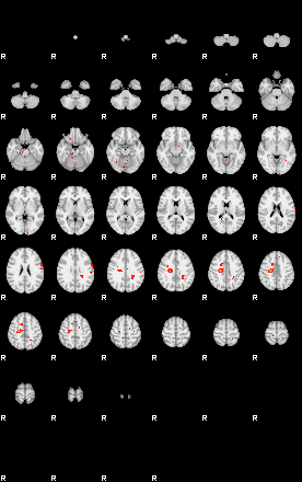 Patients 29175 154