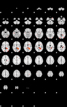 Patients 29175 176