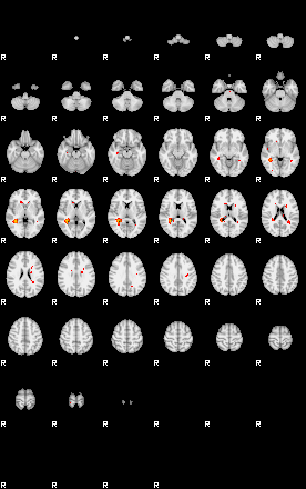 Patients 29176 151