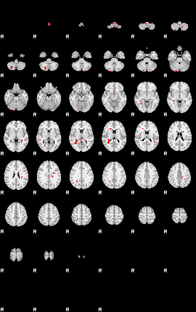 Patients 29177 187