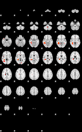 Patients 29178 138