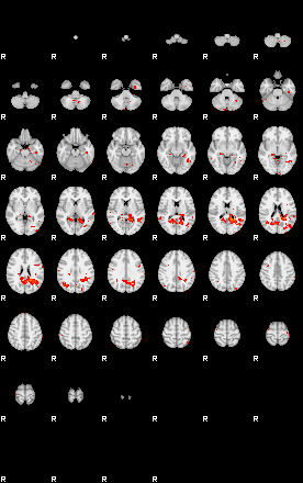 Patients 29180 158