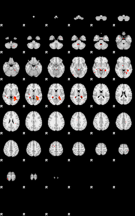 Patients 29180 16