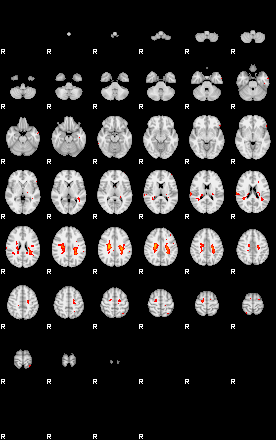 Patients 29180 75