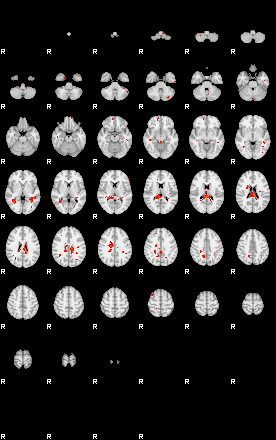 Patients 29181 164