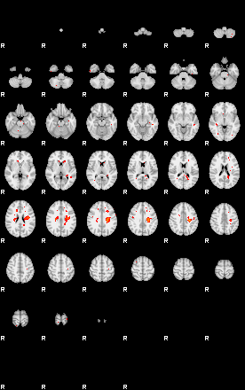 Patients 29181 179