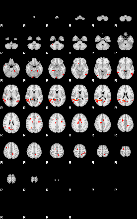 Patients 29181 69