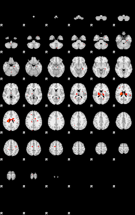 Patients 29185 55