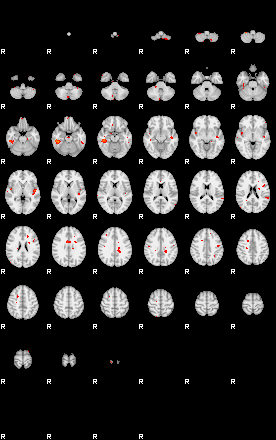 Patients 29189 196