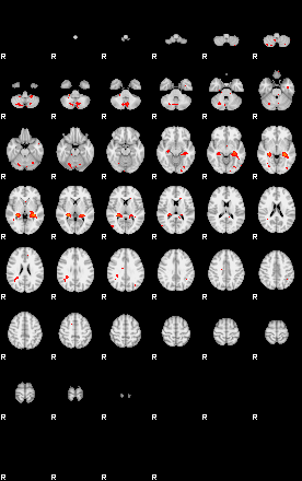 Patients 29189 94