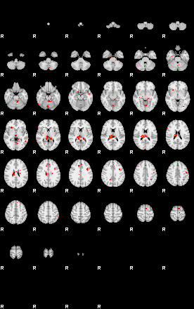 Patients 29191 56