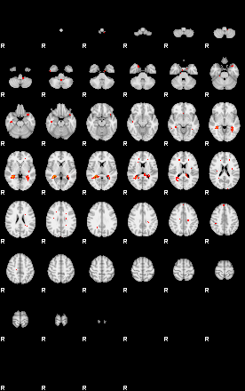 Patients 29201 87