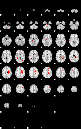 Patients 29203 180