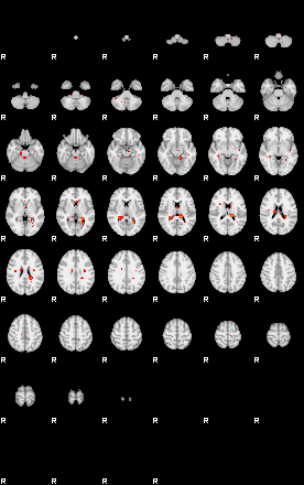 Patients 29204 51