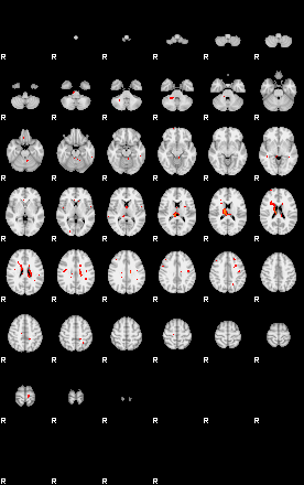 Patients 29204 52