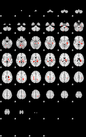 Patients 29210 170