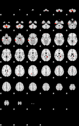 Patients 29213 100