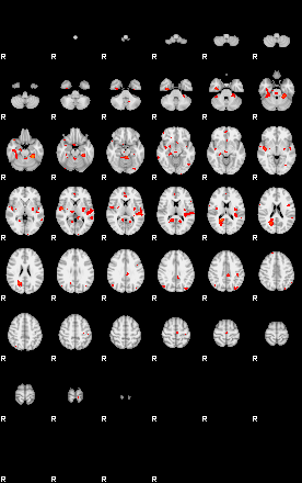 Patients 29215 126