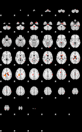 Patients 29217 182