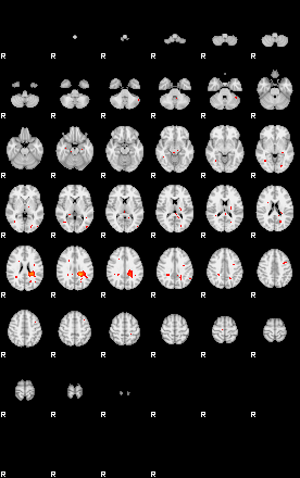 Patients 29218 25