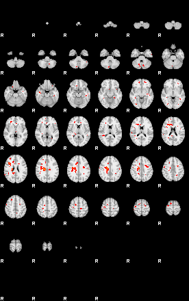 Patients 29220 85