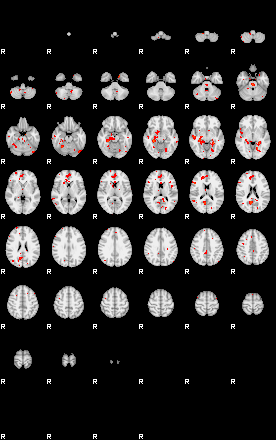 Patients 29221 161