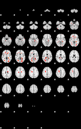 Patients 29391 75