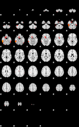 Patients 29393 193