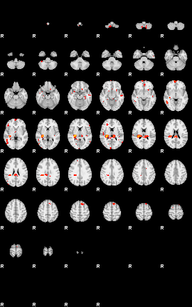 Patients 29409 99