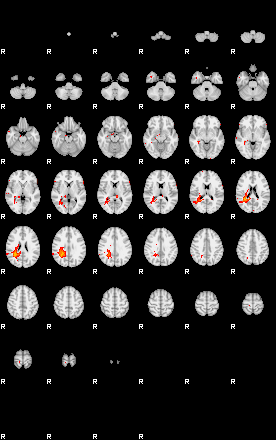 Patients 29410 121