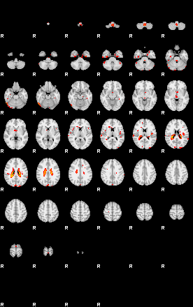 Patients 29416 175