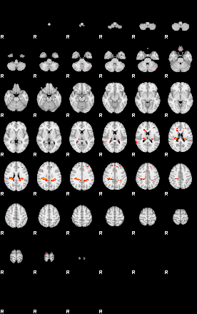 Patients 29417 166