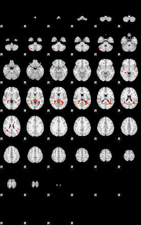 Patients 29417 198