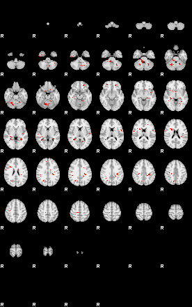 Patients 29497 11