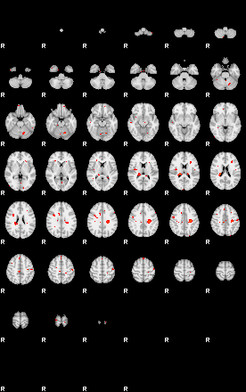 Patients 29521 200