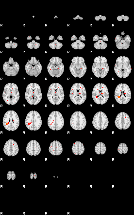 Patients 29521 50