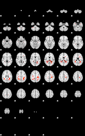 Patients 29540 155