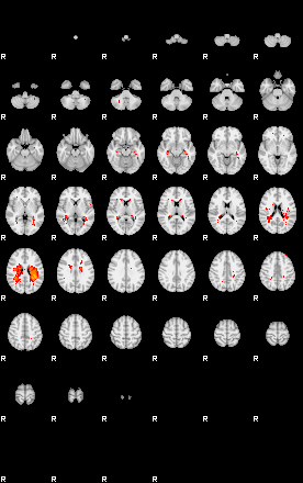 Patients 29545 24