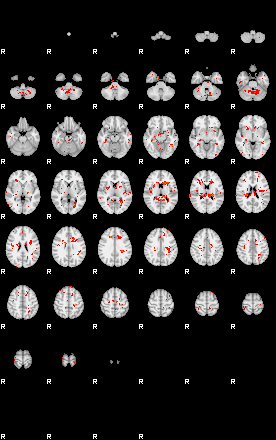 Patients 29547 21