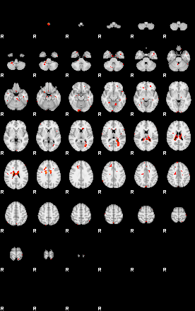 Patients 29555 4